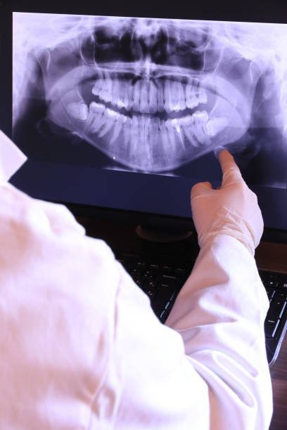 Best Broken or Chipped Tooth Repair in Congers, NY